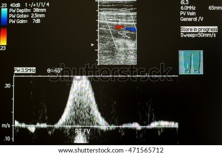 Femoral Artery Stock Images, Royalty-Free Images & Vectors | Shutterstock