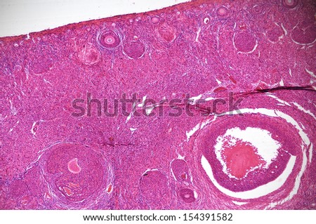 Artery Vein Cross Section Showing Differences Stock Photo 8164006 ...