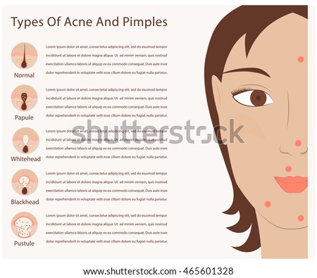 the hills babes naked pics and vids inflammation facial remedy