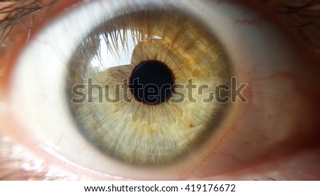 Bloodshot Stock Images, Royalty-Free Images & Vectors | Shutterstock