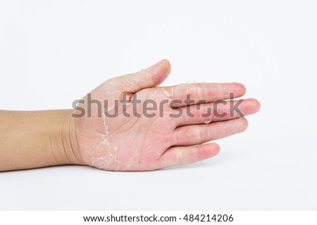 Wrist Bones Injury Stock Photo 426367180 - Shutterstock