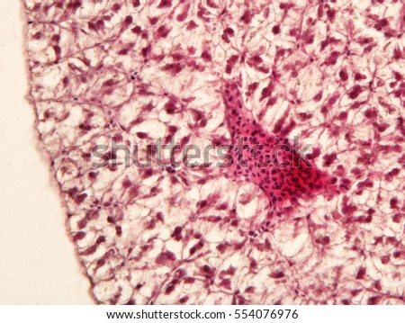 Liver Animal Tissue Under Microscope View Stock Photo 554076976 ...