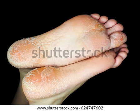 ugly foot stock images royalty free images vectors two person ugly christmas sweater