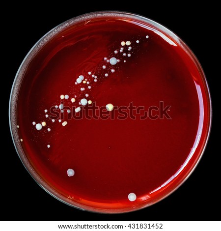 Petri Dish Molds Penicillium Yeast Mucor Stock Photo 128453309 ...