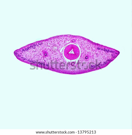 Clonorchis Sinensis Liver Fluke Magnification 40x Stock Photo 26706610 ...