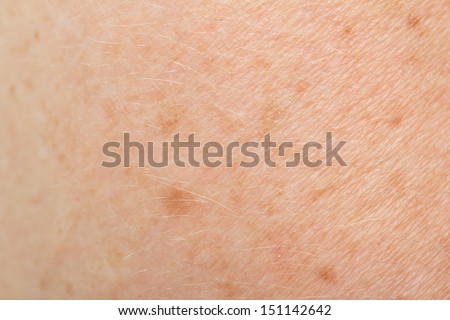 macro scar on the human skin stock photo image 61059545 burn scar stock photo 57476164 macro scar on the human skin stock photo image 61059545 burn scar stock photo 57476164
