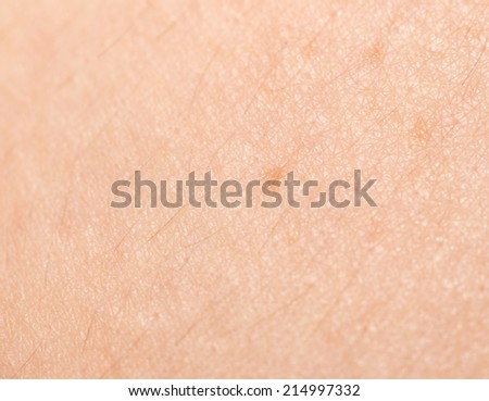 scar on human skin stock photo 121658896 scar on human skin stock photo 209491861 scar on human skin stock photo 121658896 scar on human skin stock photo 209491861