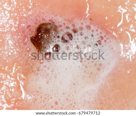 Hydrogen Peroxide Stock Images, Royalty-Free Images & Vectors