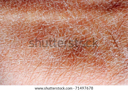 skin background stock photo 92353336 skin texture detail background stock photo 71497678 skin background stock photo 92353336 skin texture detail background stock photo 71497678