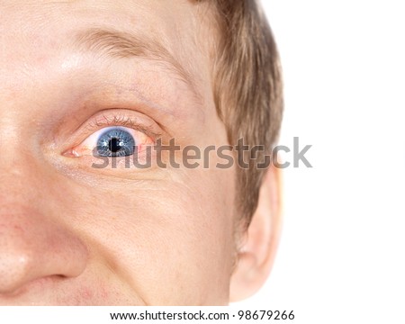 Eye Infection Stock Images, Royalty-Free Images & Vectors | Shutterstock
