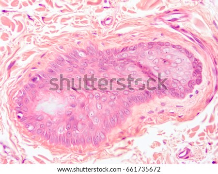 Scalp Histology Labeled