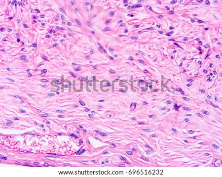 Microscope Image Elastic Artery Stained Hematoxylineosin Stock Photo ...