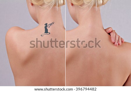 beautiful young woman before after laser stock photo 383724101 beautiful young woman before after laser stock photo 383724101