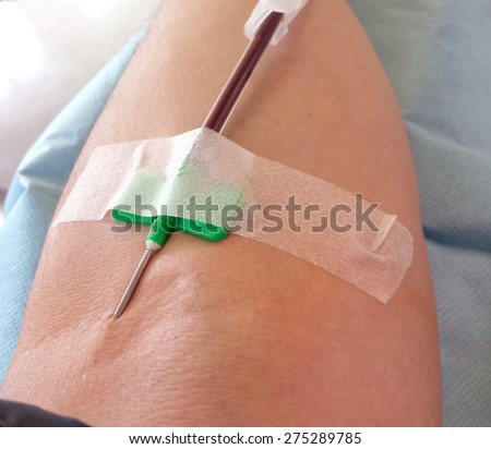 needle blood transfusion hospital donor arm during plasmapheresis shutterstock