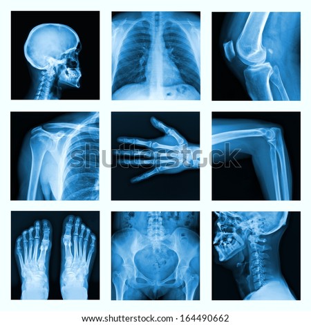 xray images