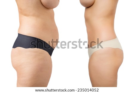 increasing topamax dosage for weight loss increasing topamax dosage for weight loss