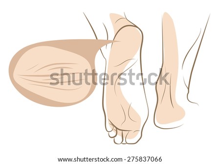 Khái niệm của da khô và nứt trên người phụ nữ bóng đá, dòng vector phác thảo