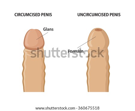 Circumcision Penis Size 91