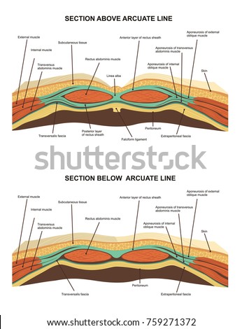 Muscles Cross Section Anterior Abdominal Wall Stock Vector 759271372 ...