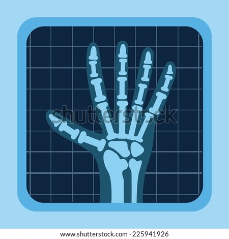 xray hand stock images royalty free images vectors