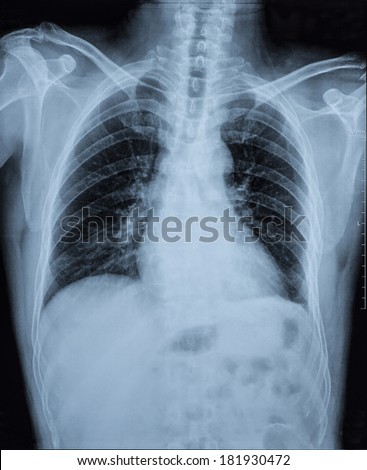 Breastbone Stock Images, Royalty-Free Images & Vectors | Shutterstock