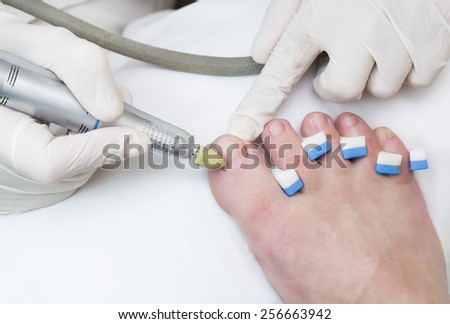 quá trình chân tại thẩm mỹ viện