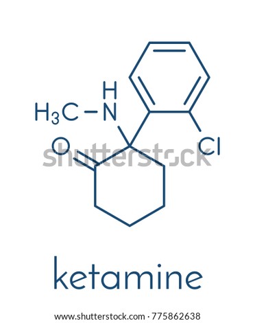 Esketamine for depression