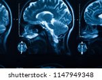 the x ray of the human brain... | Shutterstock . vector #1147949348
