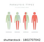 types of paralysis  ... | Shutterstock .eps vector #1802707042