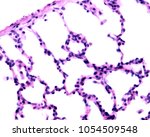 Small photo of High magnification micrograph showing the typical aspect of the lung parenchyma with many alveoli of very thin walls. The thin layer on top left is the visceral pleura.