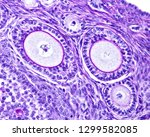 Small photo of Ovary stained with the periodic acid of Schiff (PAS) method. The zona pellucida appear stained by PAS due to its glycoprotein nature. The antrum liquid is also PAS positive.