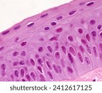 Small photo of The eye's cornea is lined by a thin non-keratinized stratified squamous epithelium. From top: 3-4 layers of squamous cells, 2-3 layers of wing cells, basal layer of columnar cells and Bowman’s layer