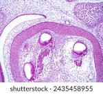 Small photo of Three sections of a developing cochlea showing the epithelial thickening that will be the organ of Corti and the spiral ganglion. The bony labyrinth of temporal bone is still in cartilaginous stage