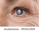 Cataract Concept. Senior Woman...