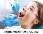 Overview of dental caries prevention.Woman at the dentist's chair during a dental procedure