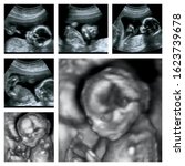 collage of 3d ultrasound of... | Shutterstock . vector #1623739678