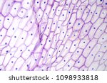 Onion epidermis under light microscope. Purple colored, large epidermal cells of an onion, Allium cepa, in a single layer. Each cell with wall, membrane, cytoplasm, nucleus and large vacuole. Photo.