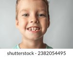 The child shows baby teeth. Pediatric dentistry and periodontology, bite correction. Health and dental care, caries treatment, baby teeth.