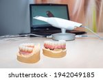 Oral cavity scanner. An electronic scanner displays video on a laptop screen. Concept - sale of equipment for dentist. Portable X-ray for the oral cavity. Dentures on dentist's table.