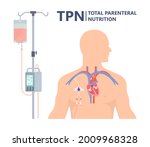 Tpn Ppn Total Tube Nutritional...