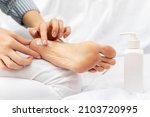 Womans hand applies moisturizing nourishing cream to the heels of feet with dry cracked skin while sitting on a white bed. Home foot care and treatment for dermatitis, eczema, dryness.