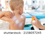 Small photo of Mother applying sunscreen protection creme on cute little baby boy kid hand. Mum using sunblocking lotion to protect baby from sun during summer sea vacation. Child healthcare travel vacation time