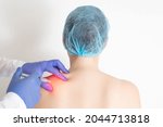 Small photo of Doctor neurologist injects medical blockade into trigger points to relieve muscle tension and pain in the back and shoulder blades, protrusion