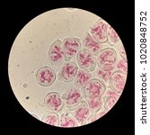 Small photo of Microscopic photo of cells with chromosomes in meiosis - cell division