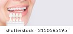 Banner tooth whitening  perfect ...