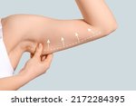 Arm of young woman after slimming on light background. Plastic surgery concept