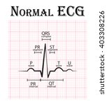 EKG - Electrocardiogram Free Stock Photo - Public Domain Pictures