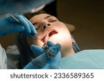 Small photo of Dental surgeon performs conduction anesthesia with lidocaine using a carpool syringe female patient's mouth before removing wisdom tooth, the maxillary third molar. Real procedure. Close up image
