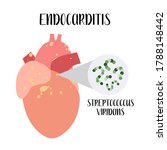 endocarditis. inflammation of... | Shutterstock .eps vector #1788148442