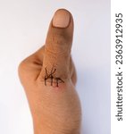 Small photo of Stitches on a thumb. Stitches used to stitch up skin of a thumb on isolated white background. Selective focus.